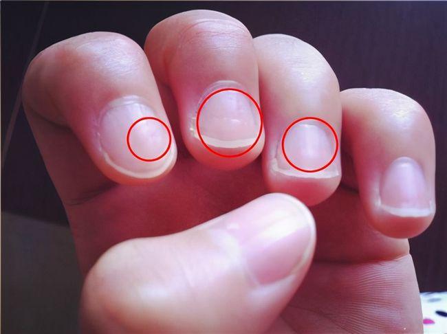 健康指甲的颜色和形状图片 指甲的颜色什么样的