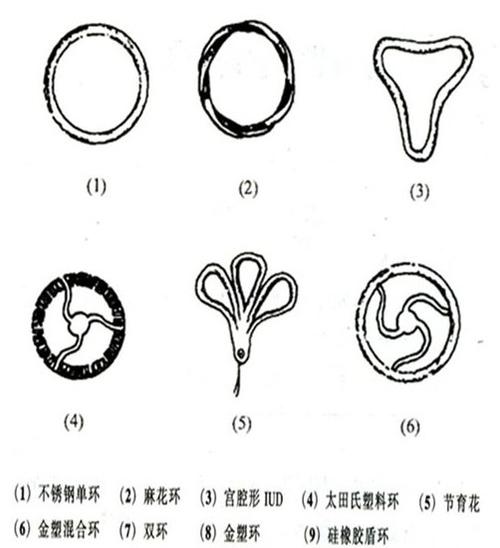 环的形状图片有几种