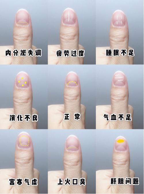 健康正常人的指甲图片 身体健康的指甲图片