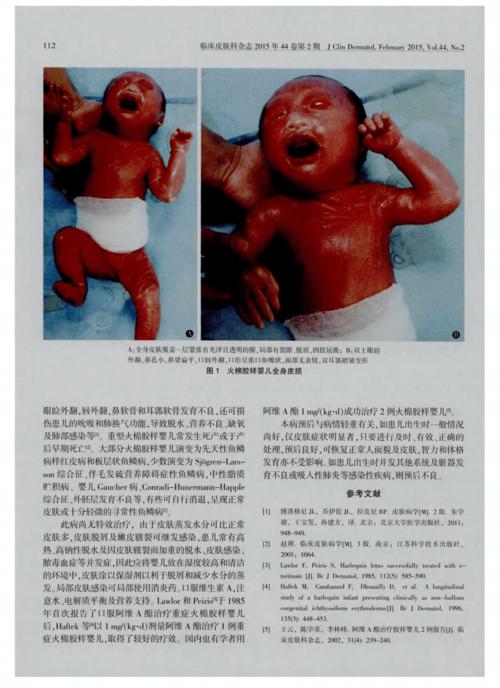 火胶棉体婴儿图片