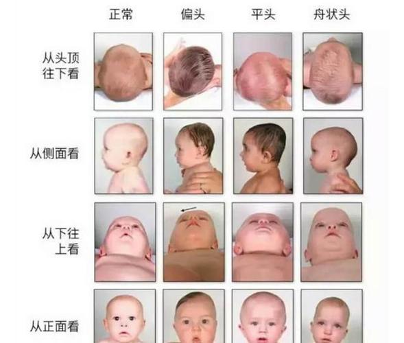 婴儿宝宝发型 宝宝婴儿发型图片大全