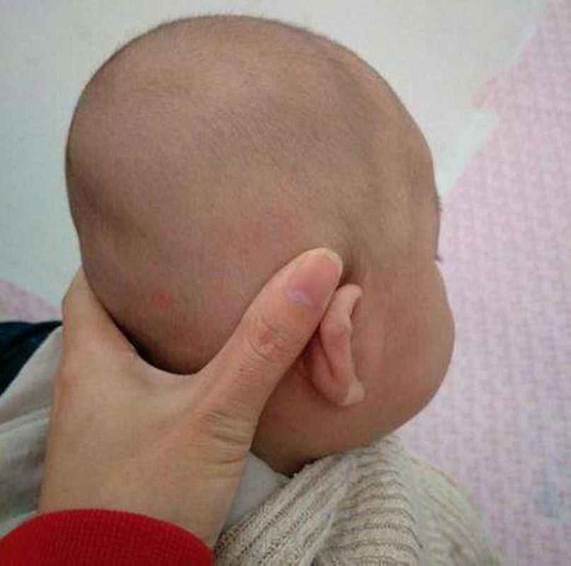 扁头宝宝适合什么发型