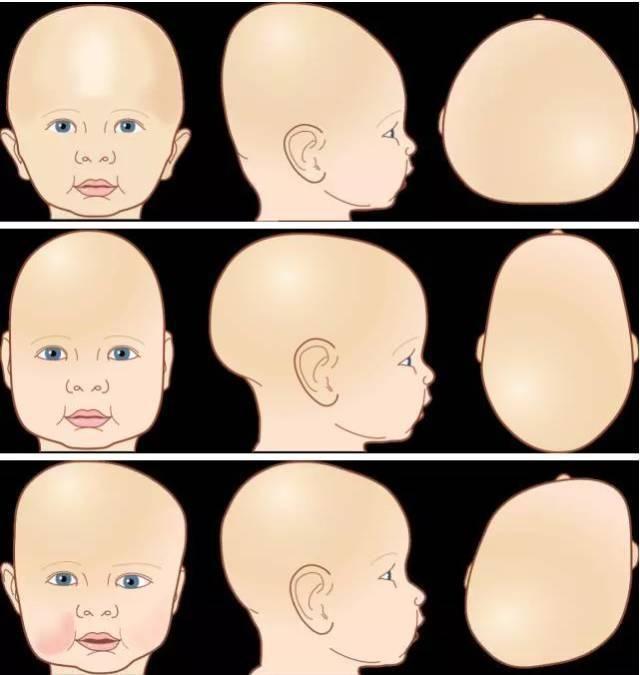 婴儿发型图