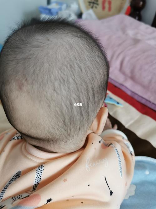 男宝宝后脑勺突出适合的发型